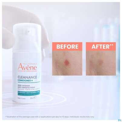Sie sehen eine Packung Avene Cleanance Comedomed Gel-cre Konzentrat 30ml, Produktbild: 19 Avene Cleanance Comedomed Gel-cre Konzentrat 30ml, A-Nr.: 5228334 - 19