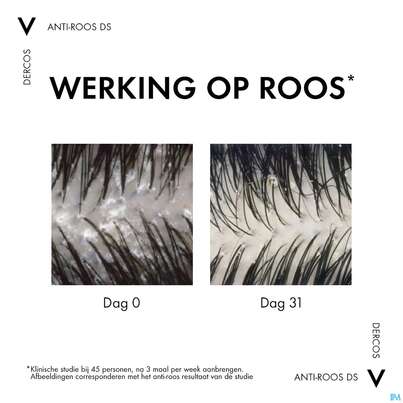 Shampoon Vichy/dercos Anti-schuppen Pflege Trockenes Haar Neu 200ml, A-Nr.: 4357414 - 22