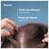 Shampoon Ducray Anaphase Haarausfall Temporaer 200ml, A-Nr.: 5961419 - 05